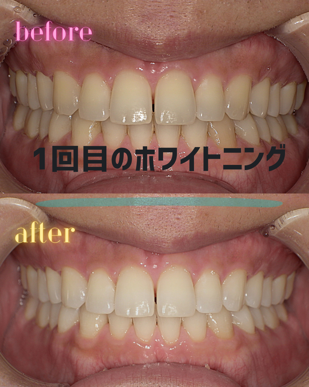 名称未設定 (Instagramの投稿（45）) (1)