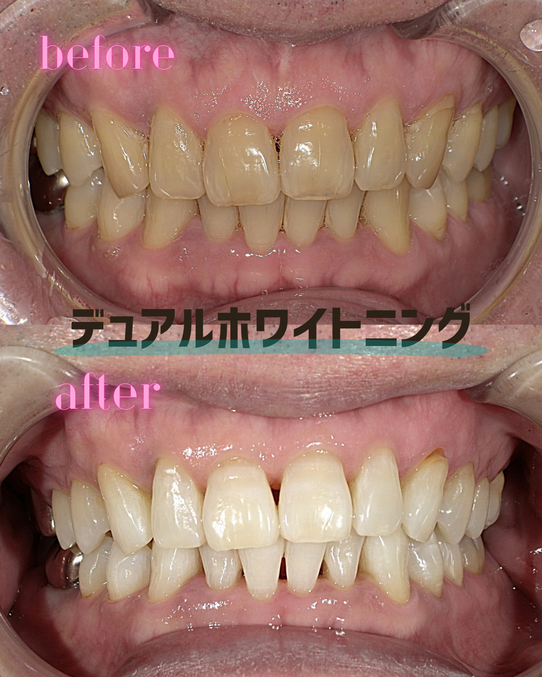 名称未設定 (Instagramの投稿（45）)のコピー - 3