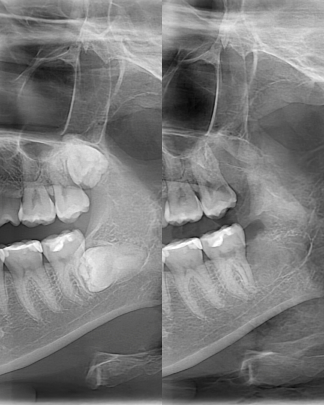 awaza-oral-surgery